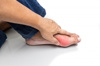 Excess Uric Acid and Gout