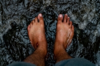 Hammertoe Relief